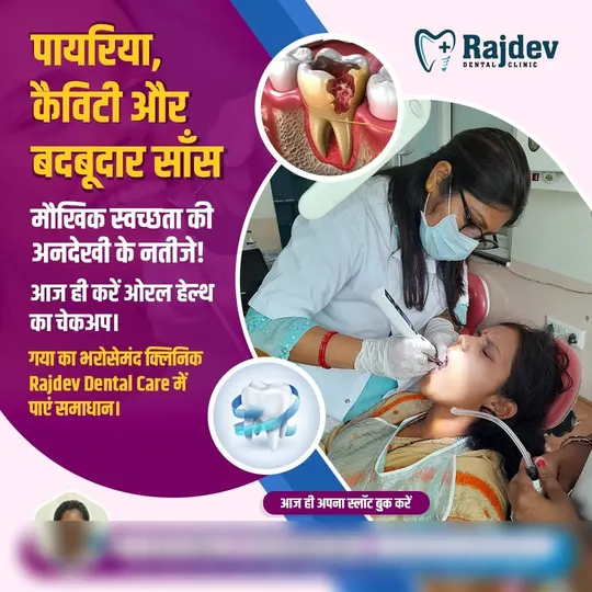 Hindi post for a dental clinic about gum disease, cavities and bad breath, asking people to book a check-up